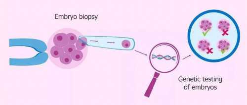 试管婴儿需要检查孕酮吗