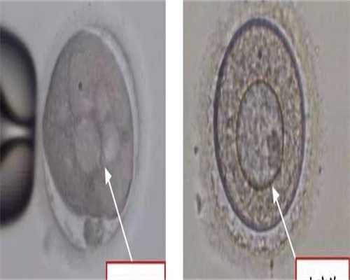 昆明做试管婴儿医院推荐哪家好，最新价格表！