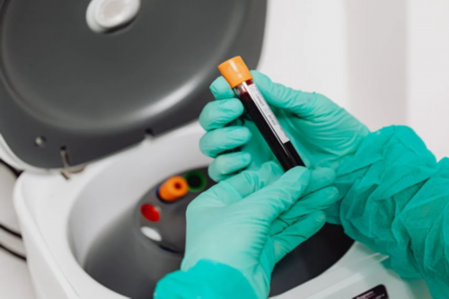 试管捐卵流程：卵巢的周期性变化