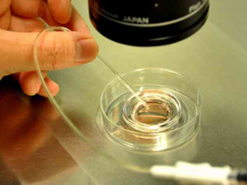 试管婴儿该如何取卵