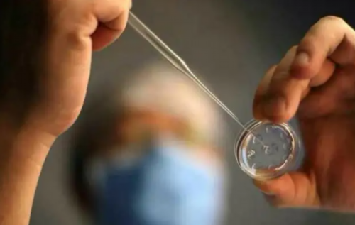 代孕包成功套餐,多囊卵巢综合症怎么调理才能好起来4个调理方式3个治疗方法可