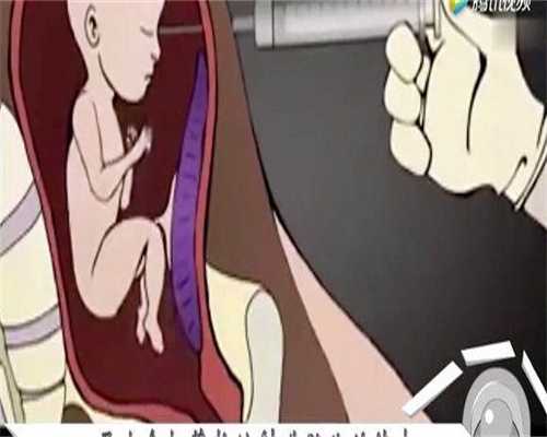 代孕哪家公司好,卵巢早衰怎么检查出来