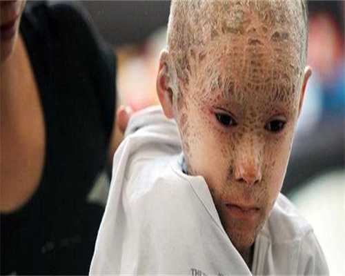 试管捐卵代怀：移植2个冻胚能着床几个？