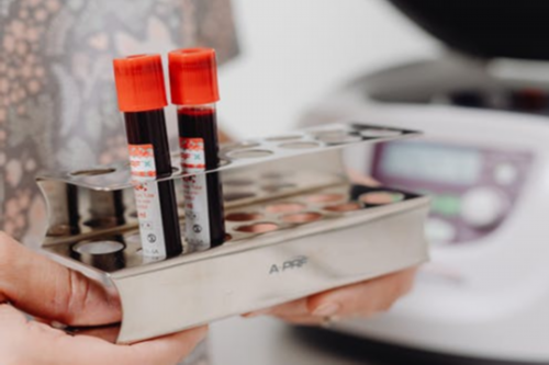 代怀包生儿子：子宫内膜息肉是做宫腔镜摘除吗