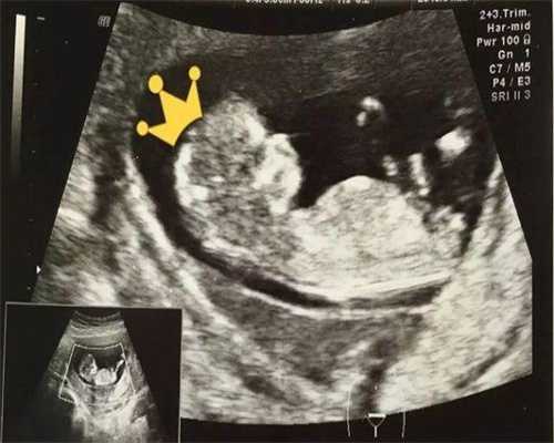 6AB囊胚移植成功率有多高？6aa的囊胚移植成功率？