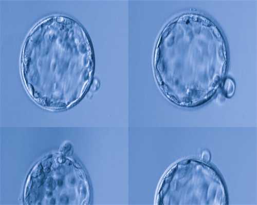 子宫肌瘤分型与治疗