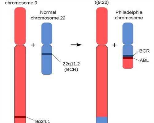 一代二代试管婴儿有什么区别