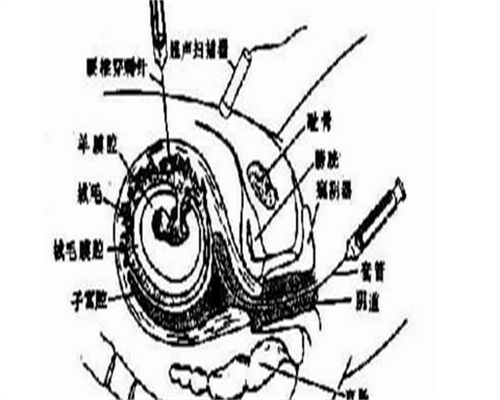 三代代生宝宝多少钱包生双胞胎准备费用十万够吗(三代代生宝宝多少钱三代代