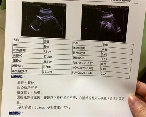 包成功助孕网_俄罗斯助孕包成功,
              孕期可以在线免费测男女的软件都