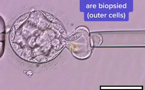昆明试管婴儿哪个医院好？2026试管医院指南