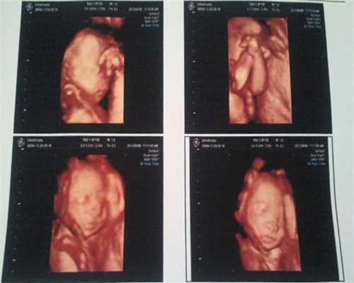 孕期检查试管婴儿要多少钱？