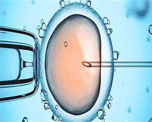试管检查卵巢怎么检查