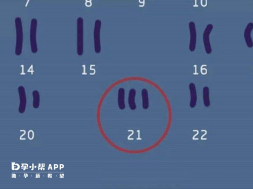 
              昆明市第一人民医院试管都是移植的双胞胎吗？

