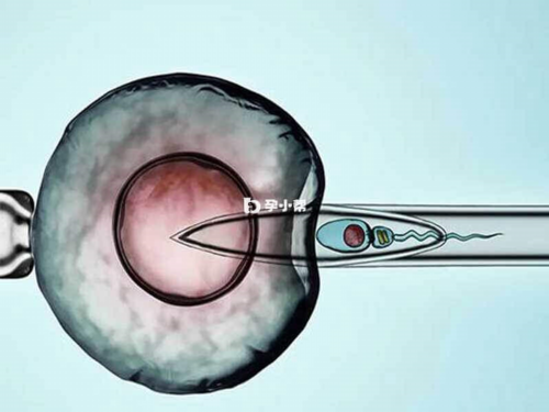 昆明试管婴儿促排卵需要多少天